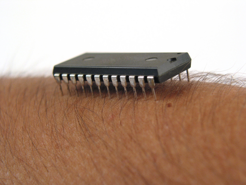 Is Implanting Chip in Your Skin a Thing?
